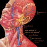 Parálisis facial.